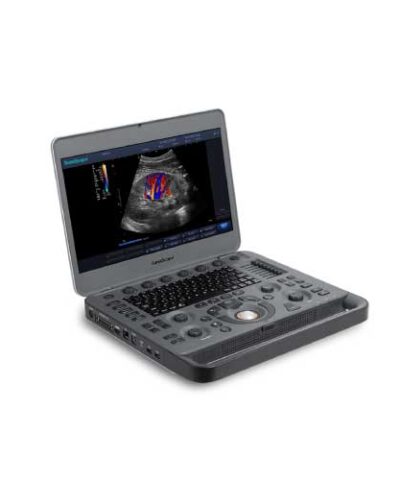 X3 portable color Doppler with abdominal probe