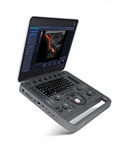 X5 portable color Doppler with abdominal probe