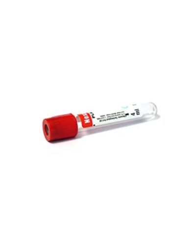 SST Tube with Gel + Clot Activator