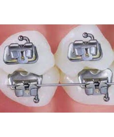 Halo Molar Band And Buccal Tube And Button