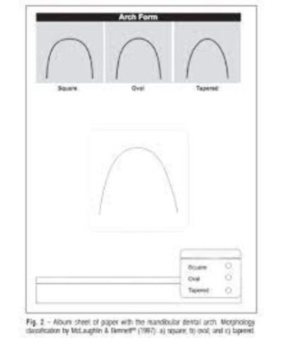 White Band Template Mandibular And Maxillary