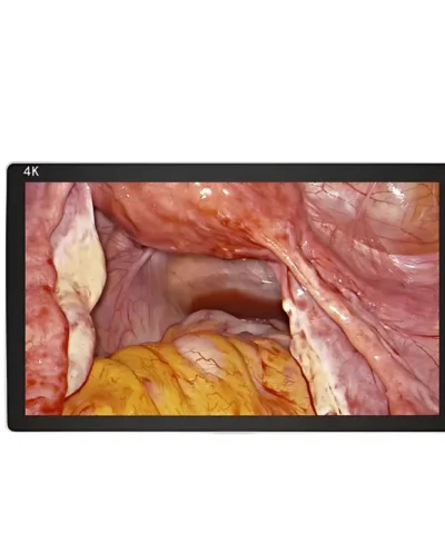 SI Surgical - 4K Monitor